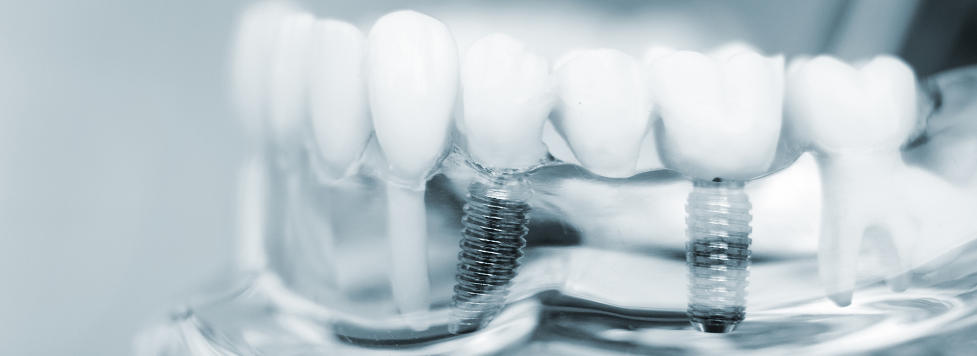 Valley Village Oral Surgery Associates | Sinus Lift, Extractions and Oral Pathology
